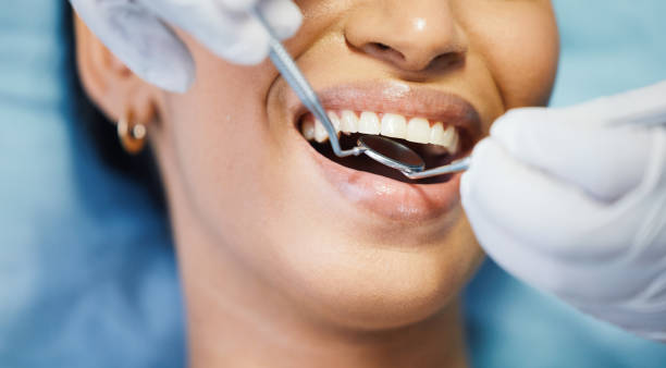 Best Same-Day Emergency Dental Services in Frazier Park, CA