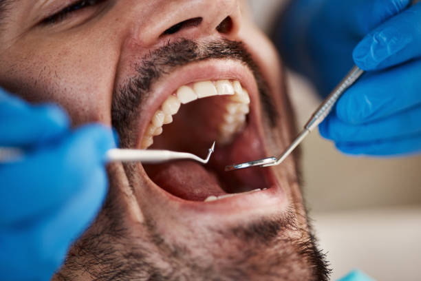 Best Weekend Emergency Dentist in Frazier Park, CA